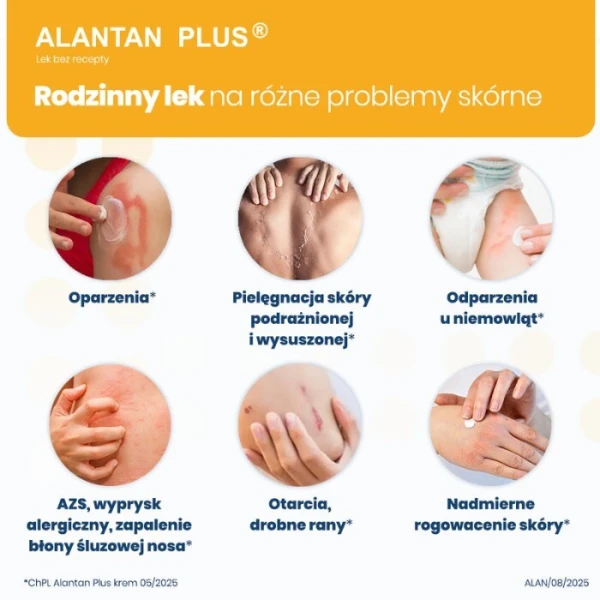 Alantan Plus (20mg+50mg)/g, krem, 35g 2